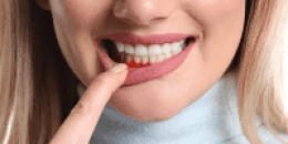 periodontia-em-santos-1-scaled 1-min periodontia-em-santos-1-scaled 1-min
